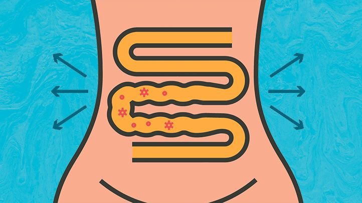 what bacteria causes ibs